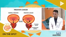 ON THE SPOT: Mga dapat malaman sa prostate cancer