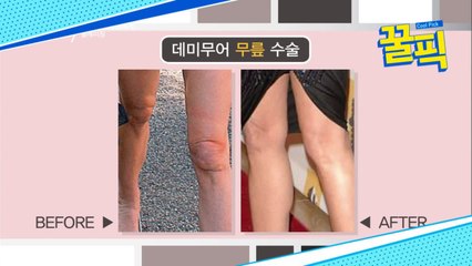 ′파란만장 연애사′ 데미무어, 젊어지기 위해 무릎 성형 수술까지?! ′충격′