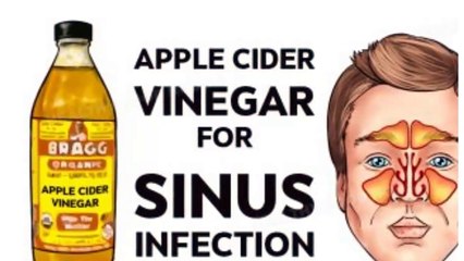 How To Kill Sinus Infection Within Minutes With Apple Cider Vinegar!