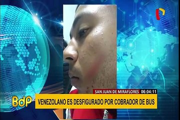 SJM: venezolano es agredido por cobrador tras subir a bus de transporte público
