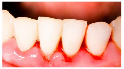 5 Signs Of Nutrient Deficiency You Can See On Your Face