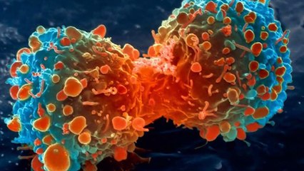 This Oil Stops Cancer Growth, According To Research.