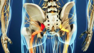 Awesome Home Remedies To Get Rid of Sciatic Nerve Pain Fast!