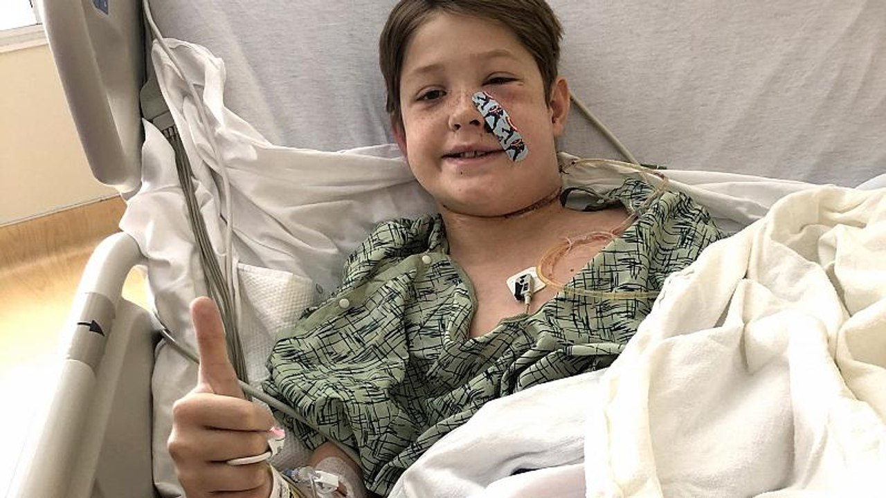 'Miracle' as boy survives fall onto BBQ skewer which impaled his skull