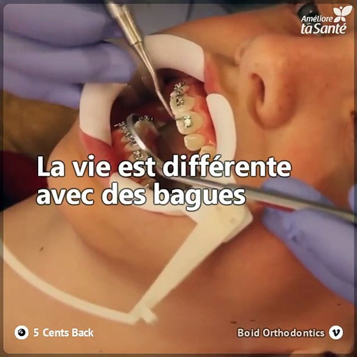 Parfois, pour pouvoir sourire sans gêne, nous devons passer par une étape douloureuse et traumatisante : l'appareil dentaire