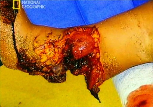 Mindennapi Tudomány - 0203 Shark Attacks