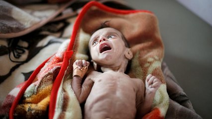 ساکنان یمن از گرسنگی به تغذیه از برگ درختان روی آورده اند