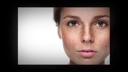 Skin Discoloration Treatment