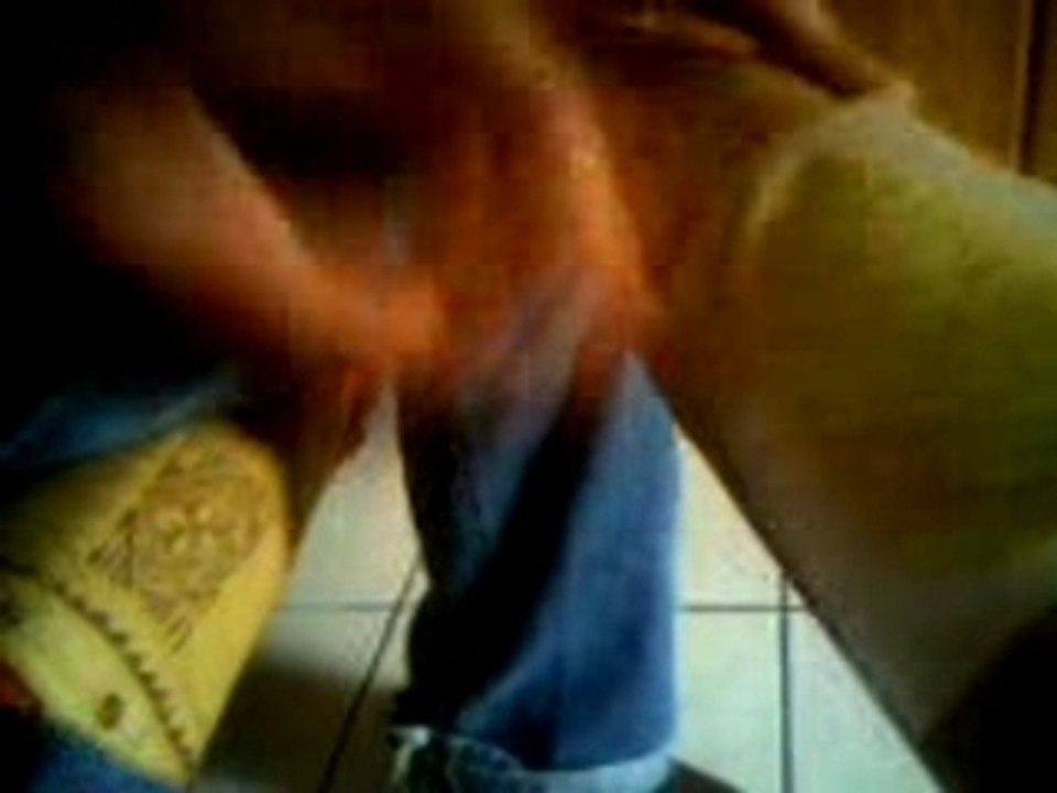 Epilation