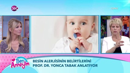 Besin alerjisi nedir?
