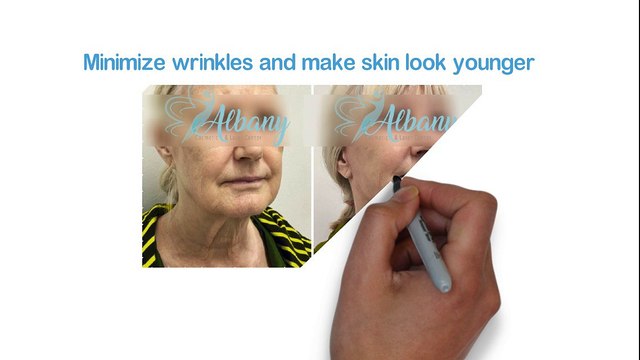 Edmonton Filler Injections