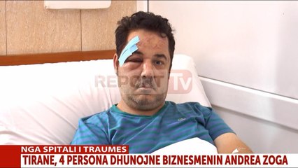 Report TV - Tiranë, flet nga spitali pronari Big Bite: Ja si më dhunuan disa banditë në mesnatë