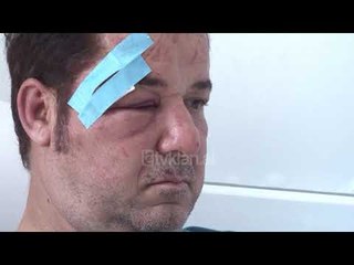 Dhunohet barbarisht biznesmeni 40-vjecar