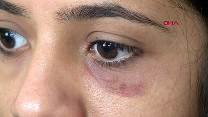 Semt pazarında 'ruj' kavgası