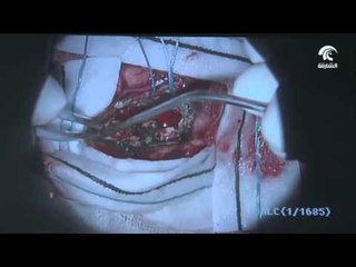 أخبار الدار : الفريق الطبي بمستشفى القاسمي ينجح في إنقاذ حياة أم و جنينها .