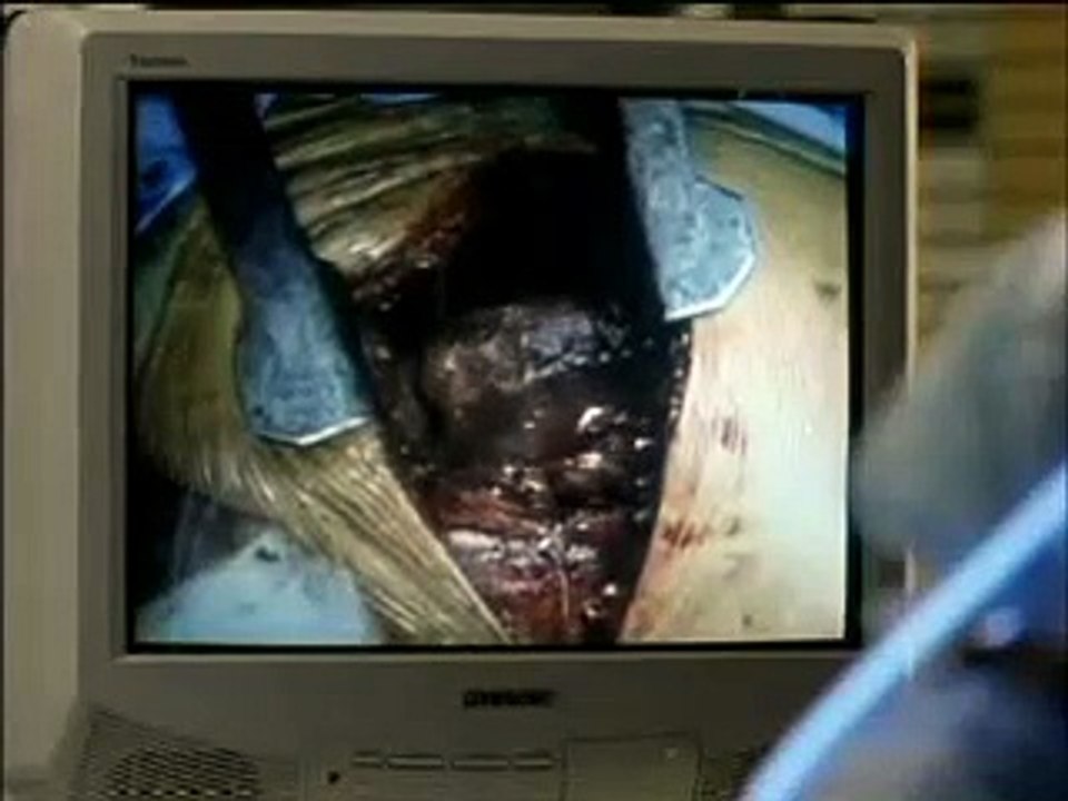 Chicago Hope S06E12