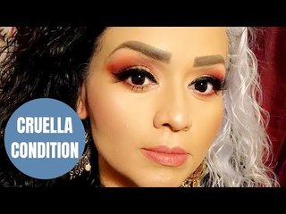 Mom says she is called Cruella EVERY DAY because of vibrant white streak caused by skin condition