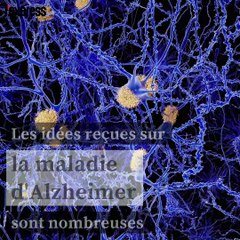 Alzheimer: 900 000 Français touchés