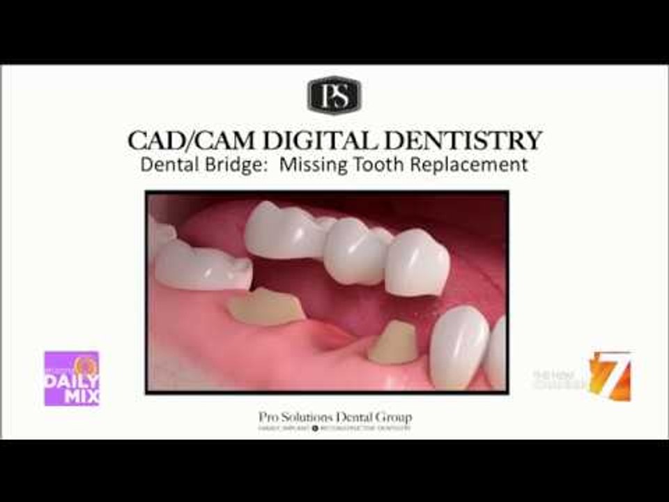 AZDMPro Solutions Dental video Dailymotion