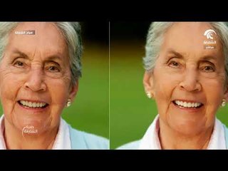 صباح الشارقة .. خرافات طبية  ..  التقدم في السن و تجاعيد البشرة