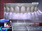 #Ezay_ElSeha / #برنامج ازى_الصحة: تجميل الأسنان مع دكتور هشام السباعى