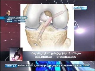 #Ezay_ElSeha /  برنامج #ازى_الصحة |  مشكلة ألام المفاصل - أصابات الملاعب مع دكتور ماجد محمد سامى