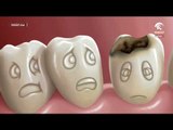 صباح الشارقة .. علاج ألم الأسنان بالأعشاب خرافة أم حقيقة