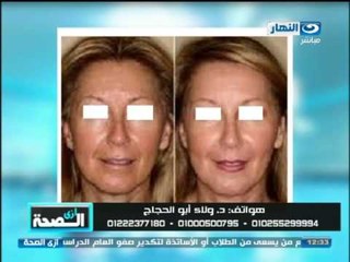 برنامج #ازى_الصحة | مشاكل البشرة وعلاج مرض البوهاق مع دكتورة ولاء ابو الحجاج