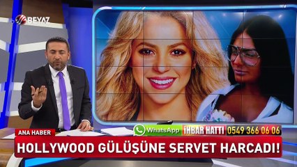 Nedir bu Hollywood gülüşü