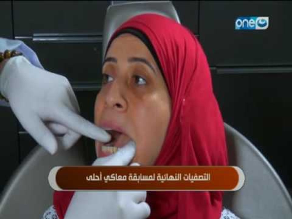 النهارده - التصفيات النهائية لمسابقة معاكى احلى مع د.محمد عماد استشارى تجميل الاسنان