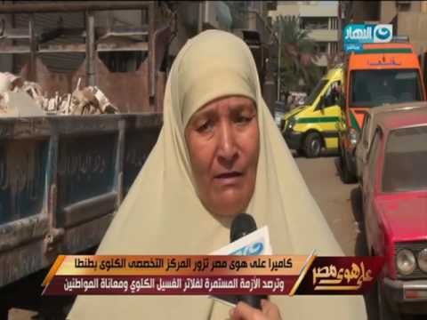 كاميرا على هوى مصر تزور المركز التخصصي الكلوي بطنطا وترصد ازمة فلاتر الغسيل الكلوي