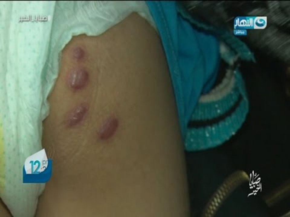صبايا الخير|  طفلة صغيرة تتعرض لأبشع أنواع العنف والتعذيب ولن تصدق من المتسبب فى ذلك