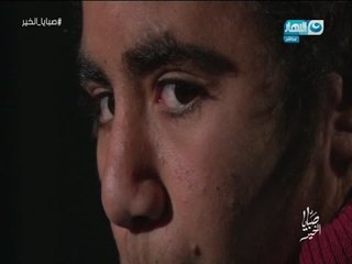 صبايا الخير | شاهد كيف تعيش "دينا " بعضو ذكري و عضو أنثوي في جسم واحد ولن تتخيل ما هو إختيارها