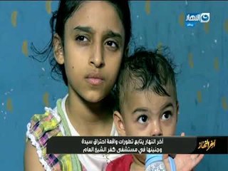 اخر النهار | مستشفي كفر الشيخ العام  ترد علي واقعة احتراق السيدة متاع  و جنينها