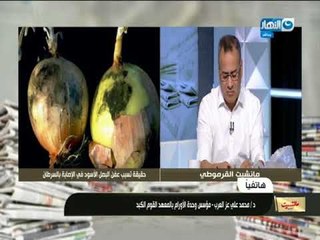 مانشيت القرموطي |مؤسس  وحدة الأورام بالمعهد القومي للكبد : لا ينصح بإزالة الطبقة السوداء على البصل