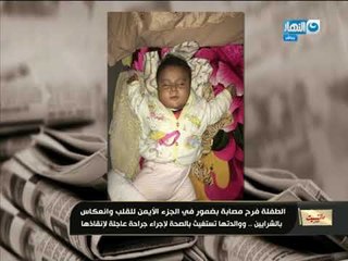 مانشيت القرموطي | والدة طفلة تستغيث على الهواء لإنقاذ إبنتها بعد إصابتها بضمور في الجزء الأيمن للقلب