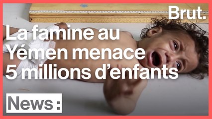 Yémen : 5 millions d'enfants sont menacés de famine