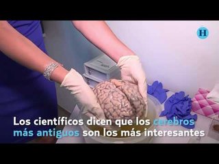 Hospital psiquiátrico almacena 3 mil cerebros para investigación médica y científica