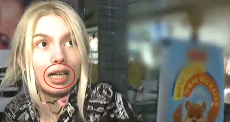 Ünlü Şarkıcı Aleyna Tilki'nin Dişleri, Sosyal Medyada Alay Konusu Oldu