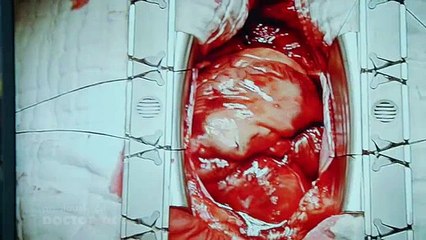 Doctor Doctor S01 E06