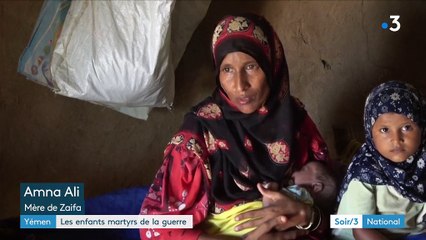 Yémen : les enfants tués par la faim ou les bombes