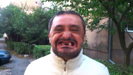 Er blieb mit nur einem Zahn im Mund