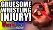 WWE Star Accused Of Bullying?! GRUESOME Wrestling Injury! | WrestleTalk News Sept. 2018