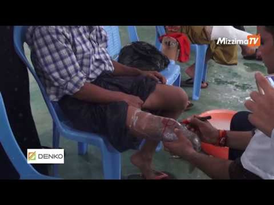 ေျခေထာက္ဆံုးရံႈးခဲ့ရသူ လူ အေယာက္ ၅၀၀ ကို အခမဲ့ေျခတုတပ္ဆင္ေပးေန