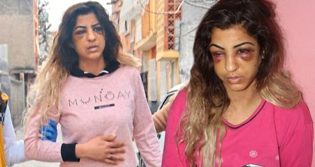 İki Çocuk Annesi, Kendisini Öldüresiye Dövüp Boğazına Bıçak Dayayan Kocasını Affetti