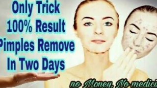 How to remove pimples in one day with trick