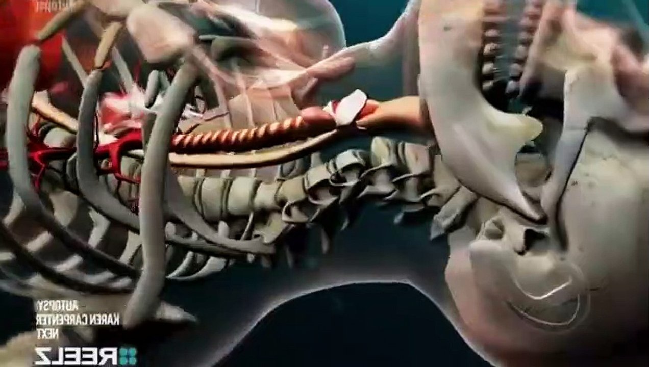 Autopsy S07  E11 Mama Cass Elliott   Part 02