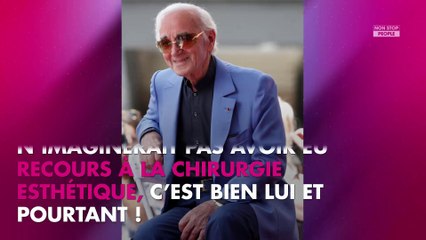 Charles Aznavour mort : pourquoi il s’était fait opérer du nez