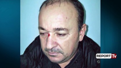 Report Tv-1 mln € nga droga, biznesmenit të dënuar në Itali i sekuestrohet kompleksi