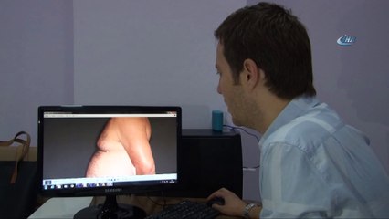 Fast food gibi ağırlıklı beslenme erkeklerin meme bölgesini büyütüyor